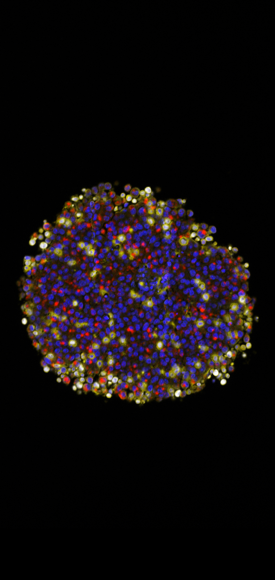 Microscopic image of a spheroid on a black background